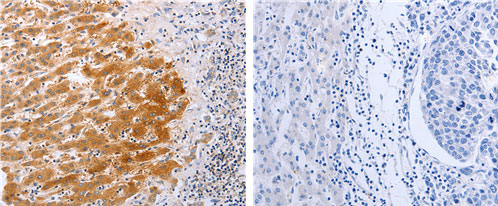 DISC1 Antibody