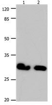 GJB6 Antibody