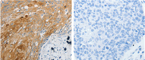 EDNRB Antibody