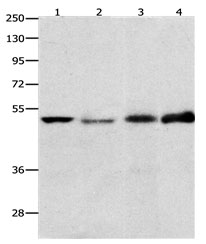 EDNRB Antibody