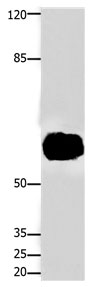 FOXJ3 Antibody