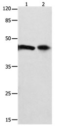 FOXL1  Antibody