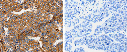 TPM2 Antibody