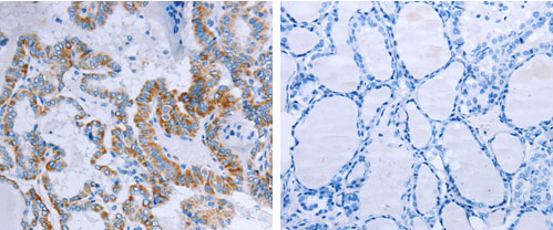 CCKBR Antibody