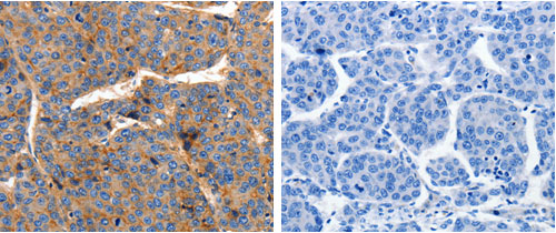 CLDN1 Antibody