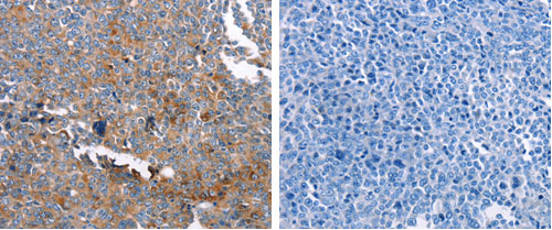 GSN Antibody