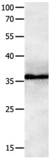 GPR3  Antibody