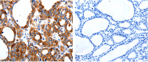 HCN1 Antibody