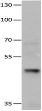 HDAC3 Antibody