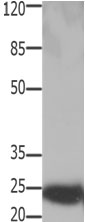 HMGB2 Antibody