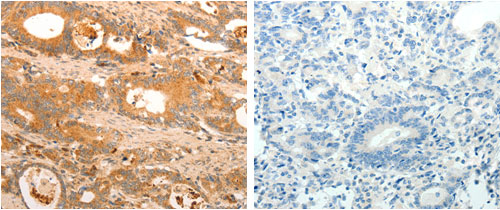 HOXA11 Antibody