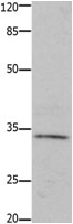 HOXA11 Antibody