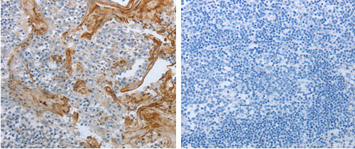 BRAF Antibody