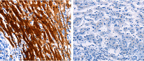 LAIR2 Antibody