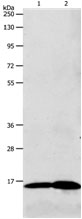 LHB Antibody