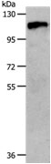 CSF1R Antibody