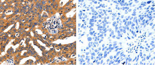 CHRNA3 Antibody