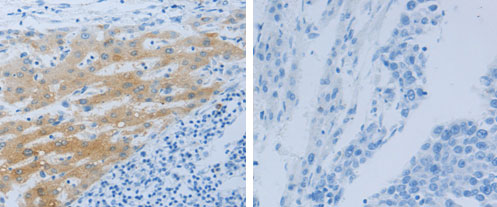 NPHS1 Antibody