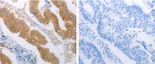 PDK4 Antibody