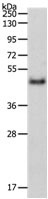 PDK4 Antibody