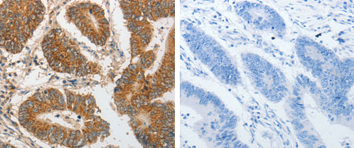 PIBF1 Antibody