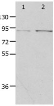 PIBF1 Antibody