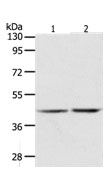 AGXT Antibody