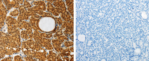 AKR1A1 Antibody