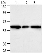 AKR1A1 Antibody