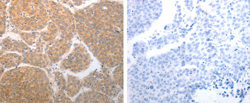 NQO1 Antibody