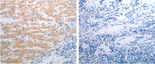 PAK1 Antibody