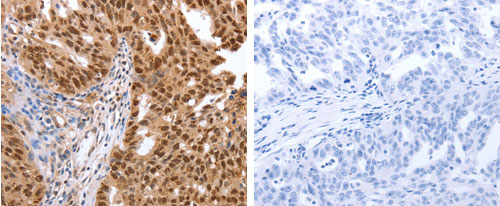 PARP1 Antibody