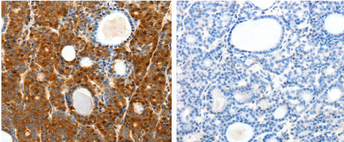 SCTR Antibody