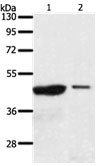 AADACL4 Antibody