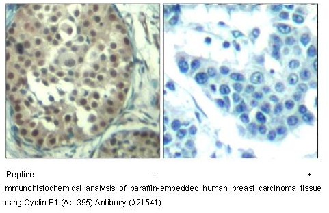 Cyclin E1 (Ab-395) Antibody