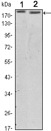 Her2 Monoclonal Antibody 