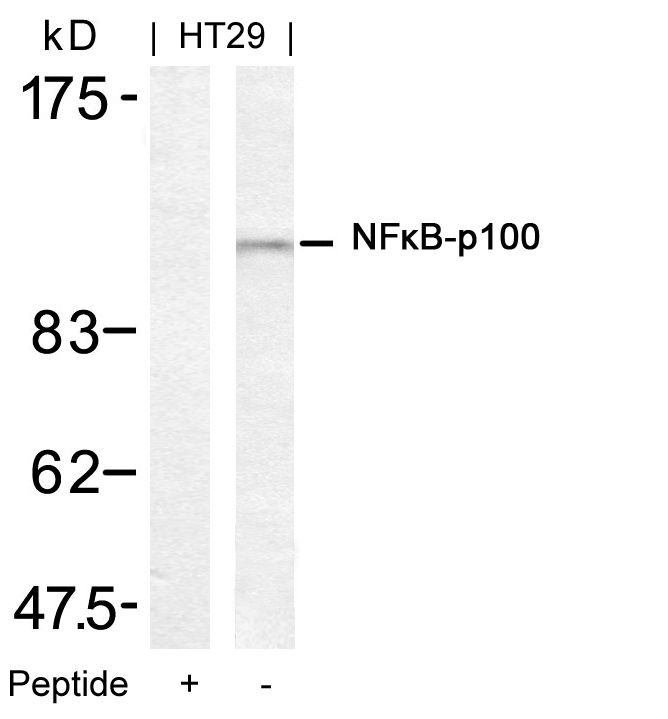 NFkB-p100(Ab-872) Antibody