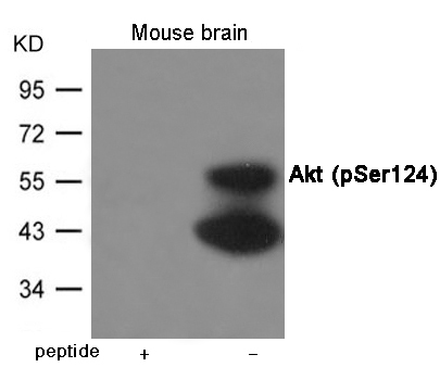 Akt (Phospho-Ser124) Antibody