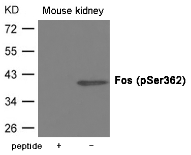 Fos (Phospho-Ser362) Antibody