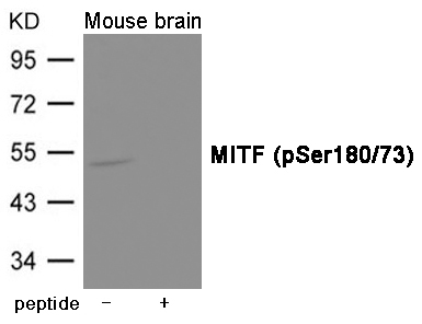 MITF (Phospho-Ser180/73) Antibody