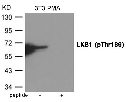 LKB1 (Phospho-Thr189) Antibody