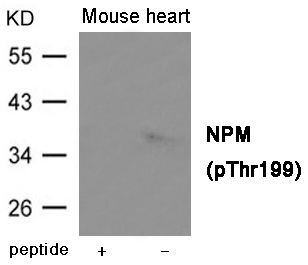 NPM (Phospho-Thr199) Antibody