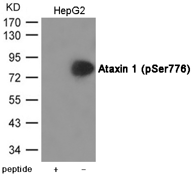 Ataxin 1 (Phospho-Ser776) Antibody