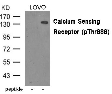 Calcium Sensing Receptor (Phospho-Thr888) Antibody