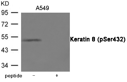 Keratin 8 (Phospho-Ser432) Antibody