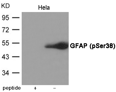 GFAP (Phospho-Ser38) Antibody