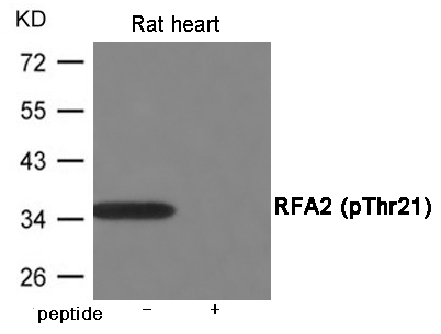 RFA2 (Phospho-Thr21) Antibody