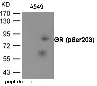 GR (Phospho-Ser203) Antibody