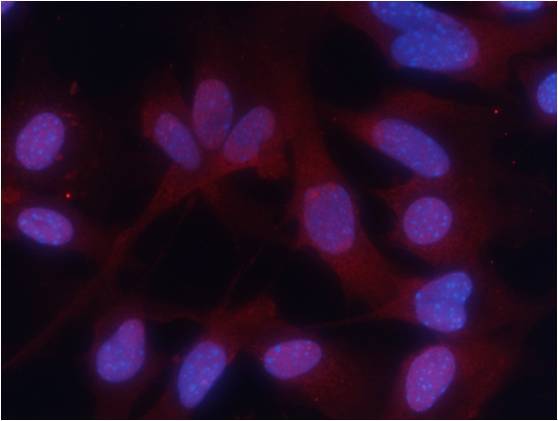 PKM2(phospho-Ser37) Antibody