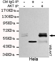 total AKT Monoclonal Antibody